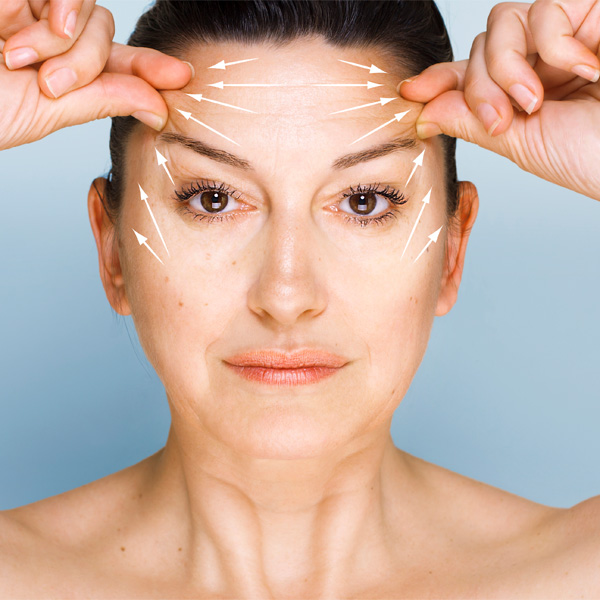 Brow lift concept